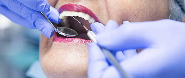 Best Emergency Care for Gum Disease in Mccla, AL