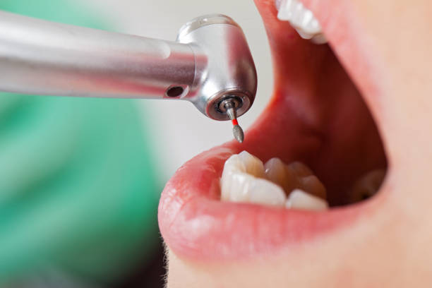 Best Emergency Denture Repair in Mccla, AL